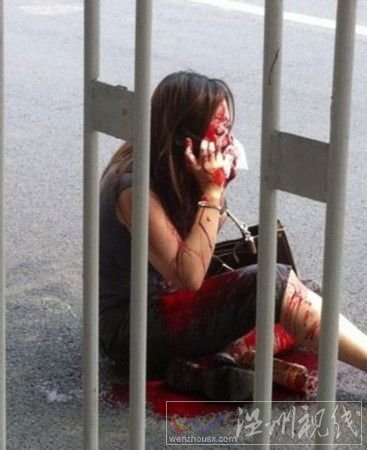 央視網(wǎng)女員工遭“割鼻”案告破 嫌犯被捕