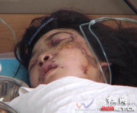 小女孩安安（化名）在湖南省桑植縣中醫院的病床上靜靜地躺著