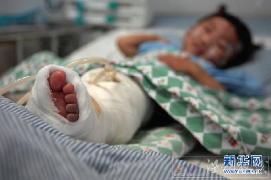 資料圖片：7月25日，重癥監護室內的項煒伊左腿被包扎著，醫生需要密切觀察其血液循環恢復情況。當日，“7·23”甬溫線動車追尾事故的最后一名獲救者、年僅兩歲零八個月的小女孩項煒伊在溫州醫學院附屬第二醫院重癥監護室內接受治療觀察。新華社記者 黃宗治 攝 