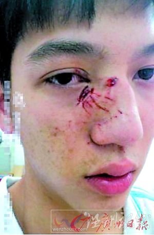 廣東兩中學秋游發生“火并” 800學生互毆(圖)