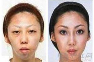 狀告老婆太丑
