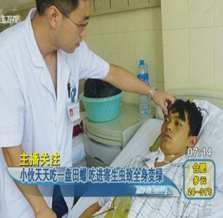 吃田螺全身變綠 吃了幾個(gè)月炒田螺吃進(jìn)寄生蟲