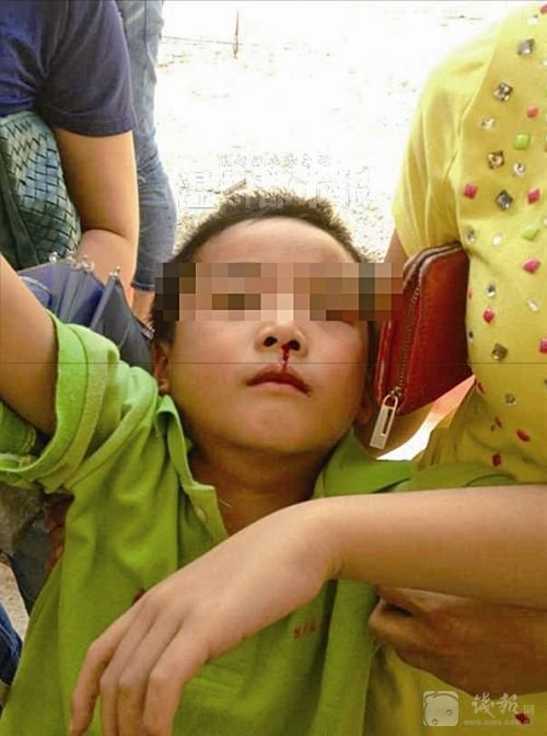 溫州樂清市北白象鎮(zhèn)第九小學19名學生氣體中毒