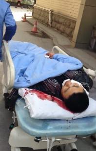 杭州一男子多看別人一眼 右臉頰被無辜砍傷