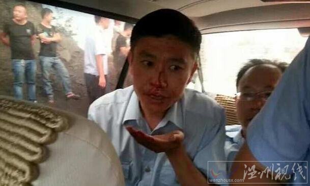 陜西法官執(zhí)法遭圍攻受傷
