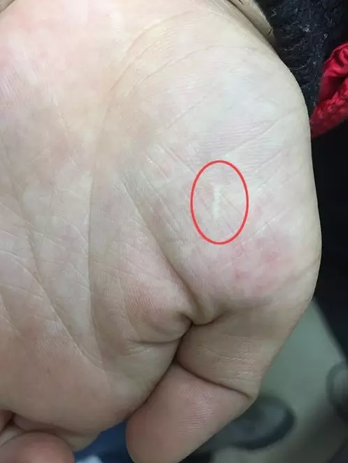 江湖游醫割手治眼