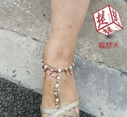 武漢小區(qū)跳蚤肆虐