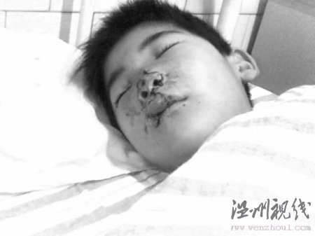 命危男孩救命捐款在醫(yī)院遭遇用錯藥和收錯費
